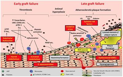 Graft thrombosis after coronary artery bypass surgery and current practice for prevention